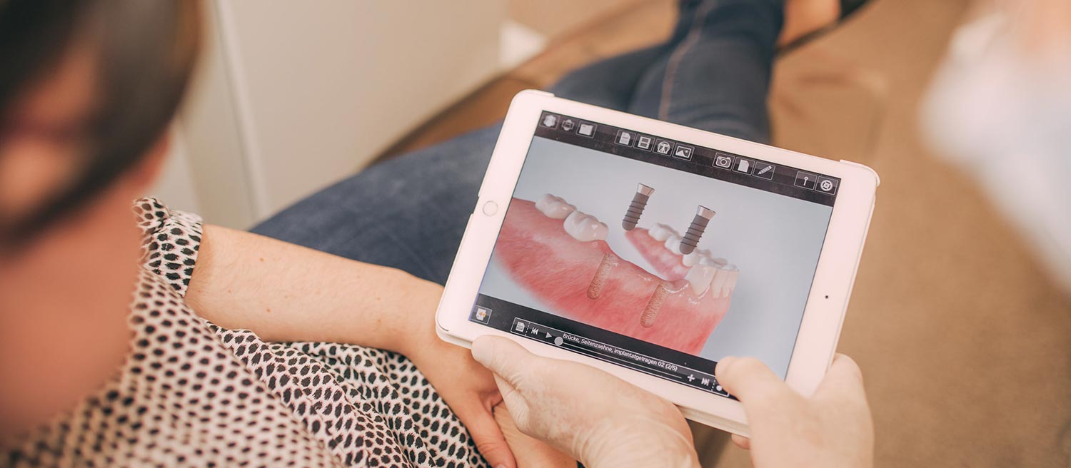 Patientin hält Tablet mit Simulation einer Zahnimplantation